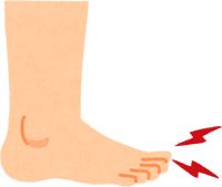 足の指が痺れているイラスト