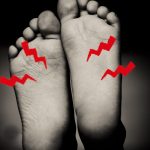 靴を履いていると足の裏が痛い…中敷きを入れると改善する？