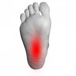 土踏まずが痛い原因は何？足底筋膜炎や足底腱膜炎の可能性が！